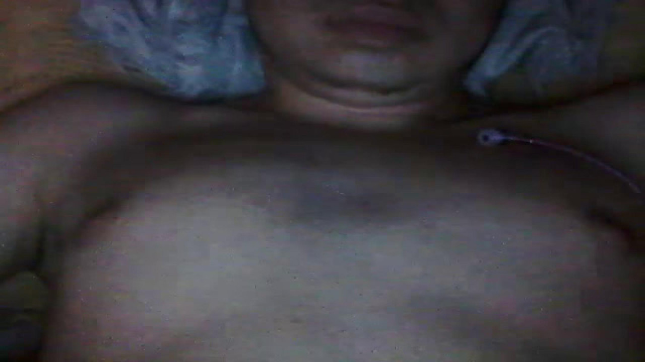 fanton1