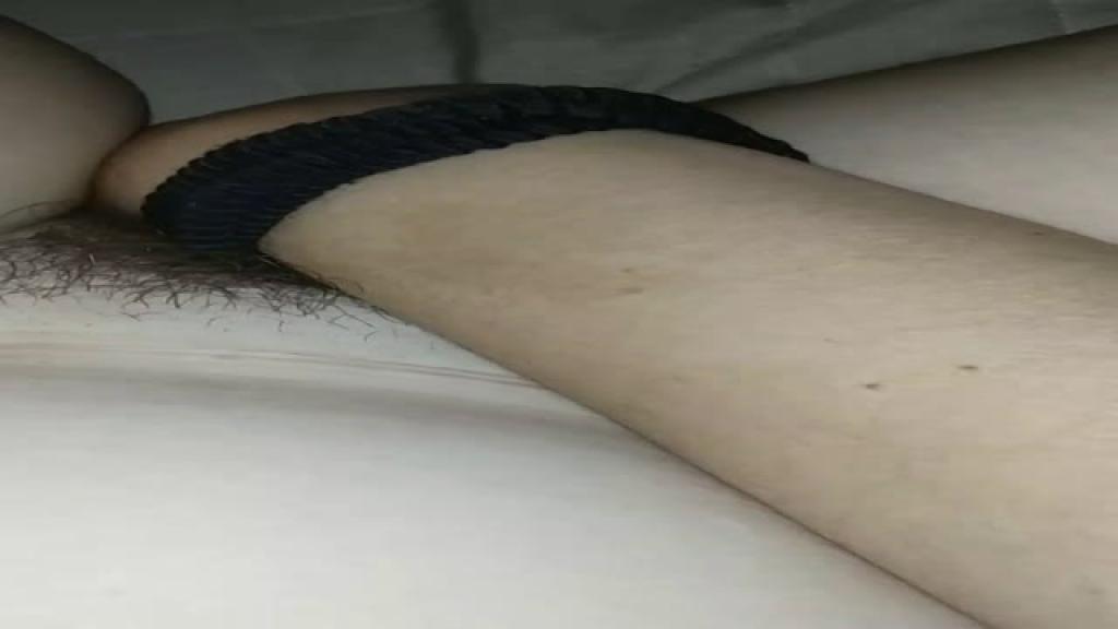 cellulitgirl